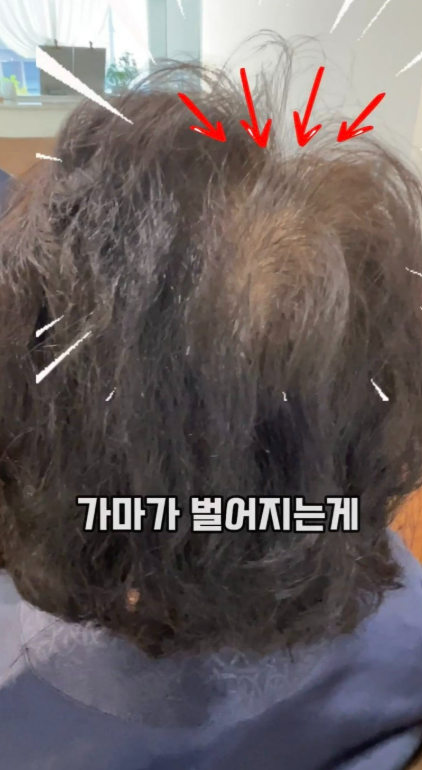 성북구 여자 레이어보브컷 가는 모발 고민 해결 시술 사례 이미지 4